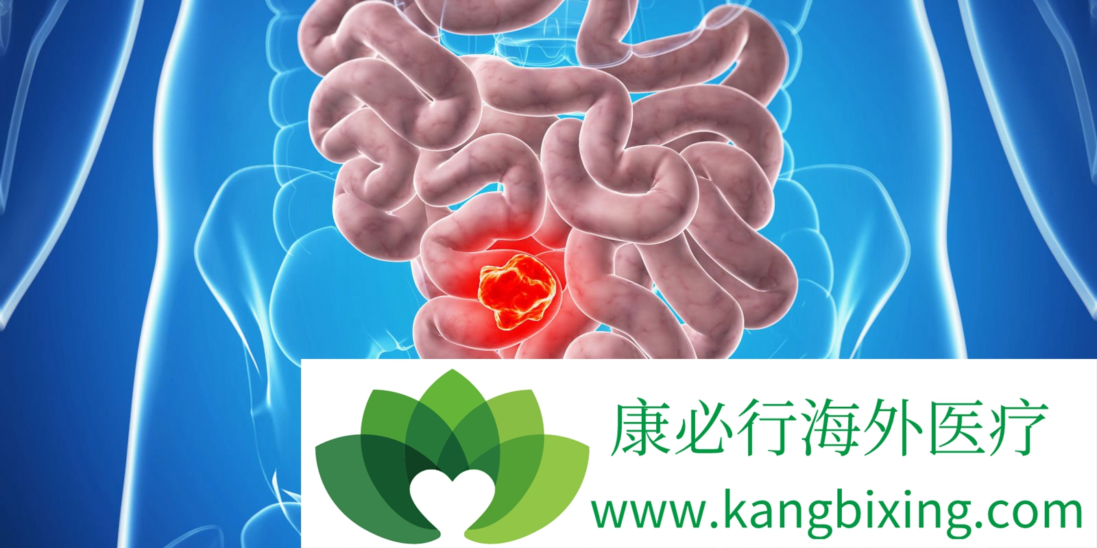 癌症治疗
