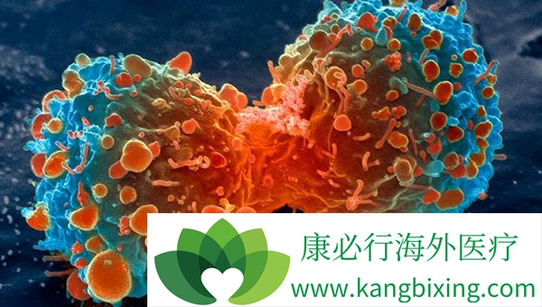 癌症 癌症治疗