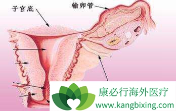 子宫内膜癌