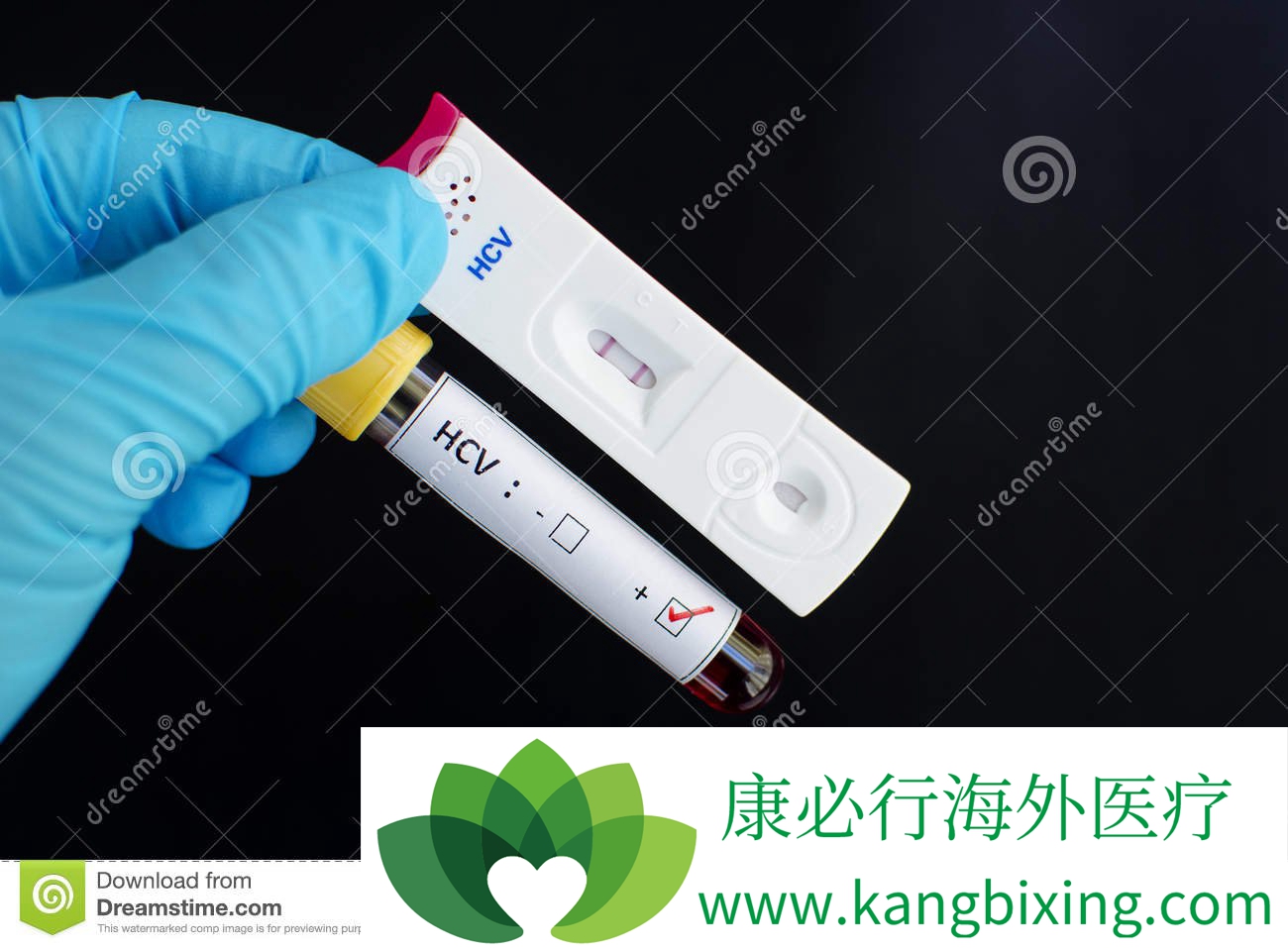 丙肝如何确诊