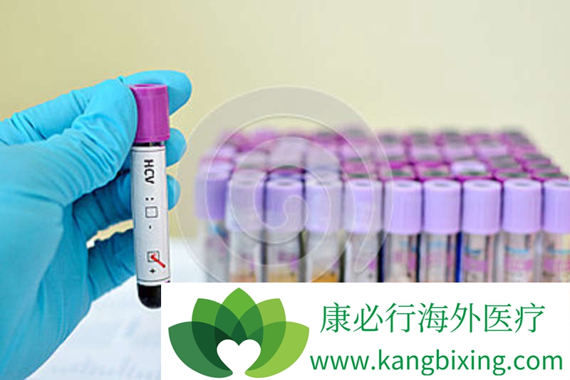 丙肝的治疗方法