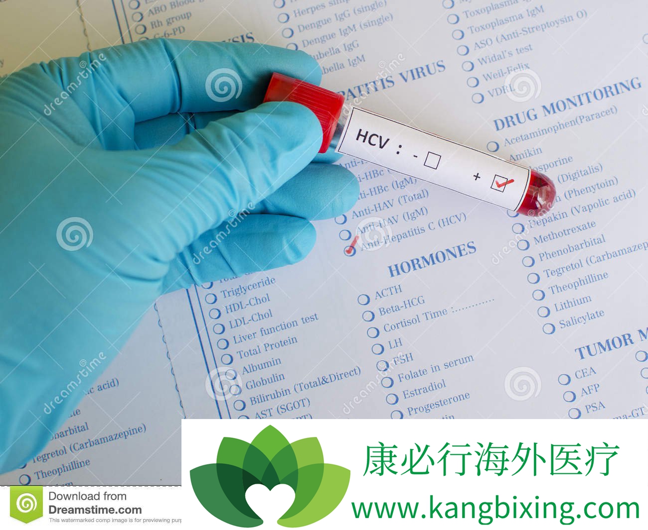 丙肝的治疗方法
