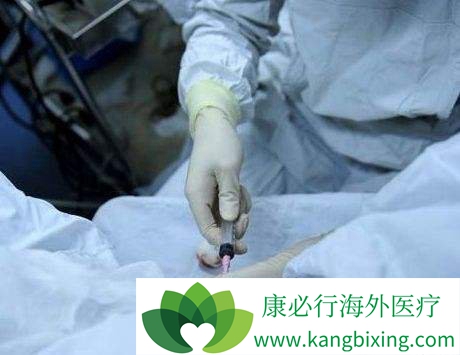 试管婴儿