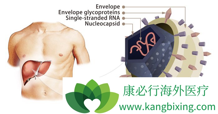 丙肝治疗