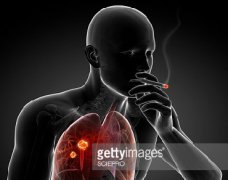 PD-1����ҩ�����ڷΰ������ܻ�ӭ