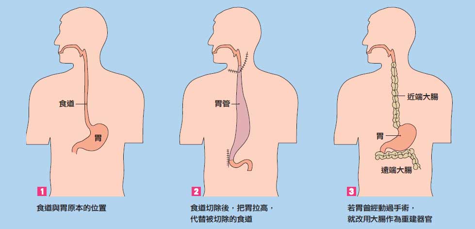 ��������ʳ����֢״����Щ����