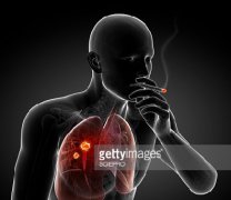 �����ΰ���ת�Ƶ����Ʒ�������Щ