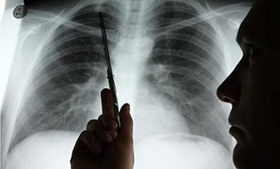 Ŀǰ���ڳ��õķΰ����Ʒ�����ȫ