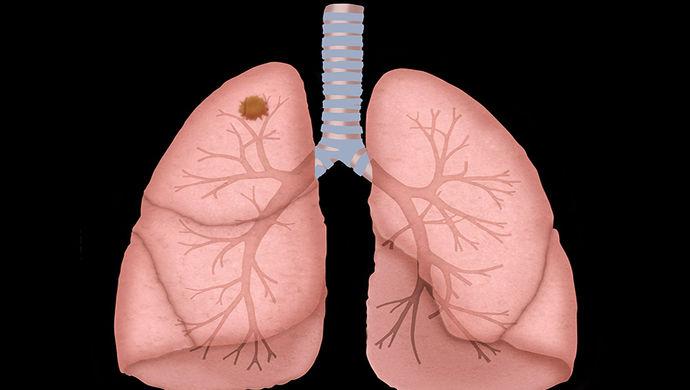 �ΰ�����ҩ�������ڷΰ���Ч��