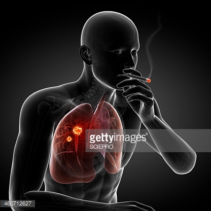 ��ͬ�����ѡ��ͬ�ķΰ����Ʒ���