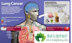 EGFRͻ������ڷΰ�����ҩ����ѡ��������