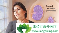 �ܰͰ�����֢״��Ҫ�������ǵ�����