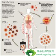 CAR-T�Ʒ�KYMRIAH�Ǵ���������ϸ���Ʒ�