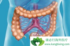 ������������θ����ֱ�����ķ���ԭ��