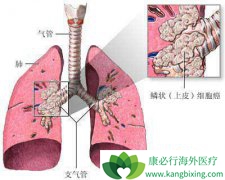 ���ڷΰ��۰�����������Щ��������ѡ��