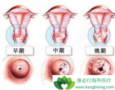 �����Ϊ�ձ�������ӹ���֢״