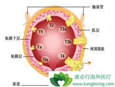 Ѫ������Ϊ���������ڰ��װ�֢״