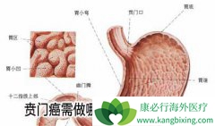 �����ڵ����Ű�֢״�ɼ�ƶѪò