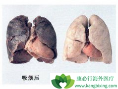 �ڷΰ�����������֮��ΰ��ᴫȾ��