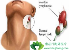 ��������ܰ�������Ҫԭ������Щ