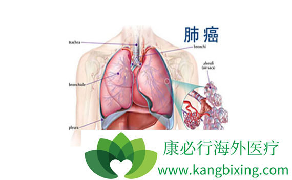 �ΰ�������ô����