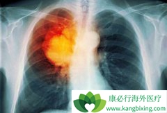 �ΰ���չ���˷ΰ�������ʲô֢״