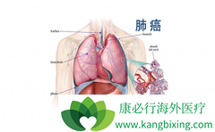 �ΰ�������ô����Ч���÷��õ�