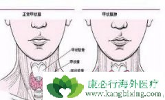 �����������м�״�ٰ�֢�Ŵ���