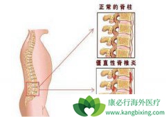 �ܽ��׵Ĳ����İ�֢��ǿֱ�Լ�����