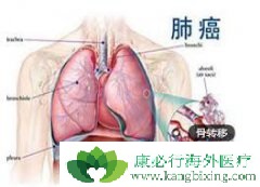 �ΰ���ת��֢״�����Ϊ��ʹ�͹���