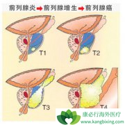 ������Ӿ������Ԥ��ǰ���ٰ�֢