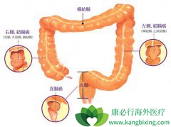 �󳦰�֢״�����Ե�һ���Ǳ�Ѫ