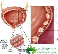 ��ʹ��Ѫ��������Ҫ�İ��װ�֢״