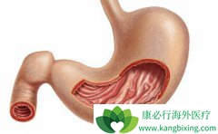 �������Ű�֢״����Щ�ǱȽϳ�����