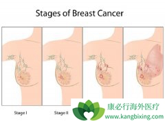 ����Ů�Ե����ٰ�֢״����Щ