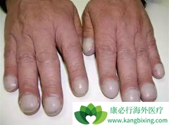 ��Ϊ�����ķΰ�������֢״����Щ