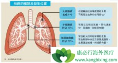 ����ΰ�����֢״�ĳ�������Ԥʾ�ΰ�ת��