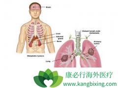 ��ʹ�����ױ����Եķΰ�����֢״