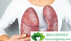 ����������ķΰ���������֢״