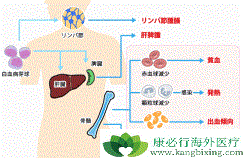 CAR-T�Ʒ��ǰ�Ѫ�����ߵĸ���