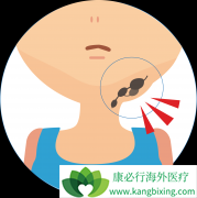 �������ܰ������Ĵ�֢״����Щ