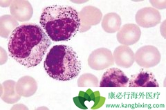 ����Bϵ�ܰ�ϸ����Ѫ����һ�ೣ���ļ��԰�Ѫ��