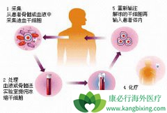 Ŀǰ��Ҫ���Ʒǻ�����ܰ����ֶ�����Щ