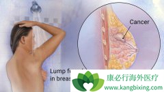 90%���ٰ����߶����׿��������ٰ�֢״