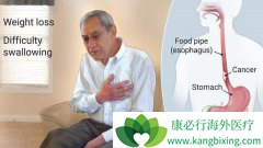 ��������������֢ʳ����֢״����Щ��