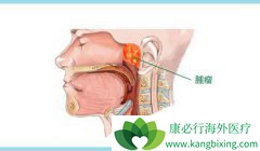 ���ڿ��ܳ��ֵı��ʰ�֢״�Ƚ϶�