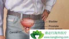 ����ǰ���ٰ�֢״һ�㲻̫����