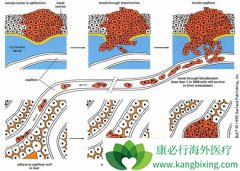 �����Ƿ����ɰ�֢ת�Ƶķ�����