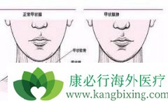 ��״�ٰ�֢�����ʸ�����й�ϵ��