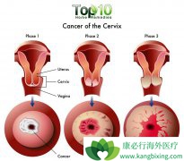 ���ڹ�����֢״�����Ե��ǲ������Ѫ